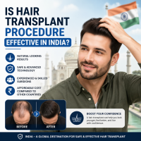 Is Hair Transplant Procedure Effective in India