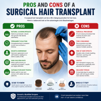 Pros and Cons of a Surgical Hair Transplant